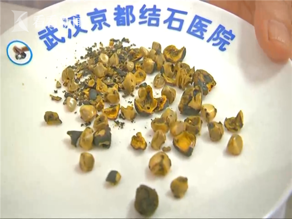 爱游戏体育